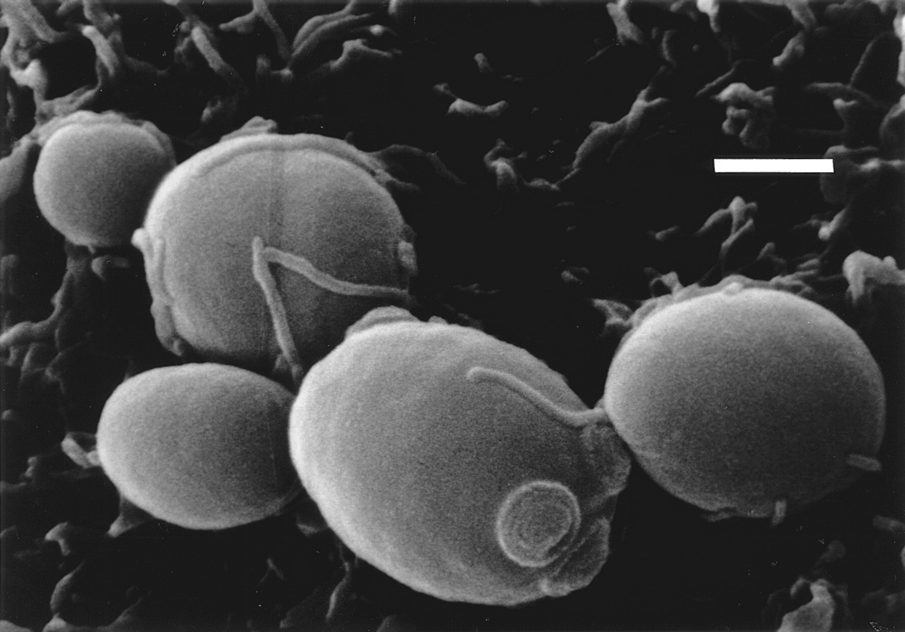 images/candida glabrata.jpg